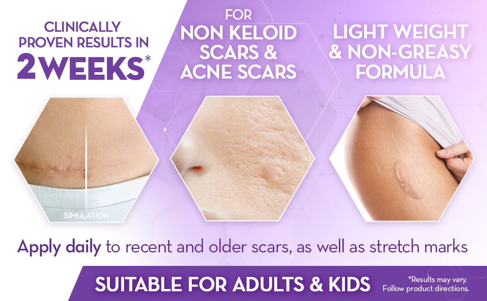 Advanced Scar Gel