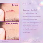 Cicatricure Face & Body Advanced Scar Gel, Scar Treatment for Old & New Scars, Fades Stretch Marks Away, Surgical Scars, Injuries, Burns and Acne Scar Treatment, For Adults &...