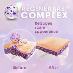 Cicatricure Face & Body Advanced Scar Gel, Scar Treatment for Old & New Scars, Fades Stretch Marks Away, Surgical Scars, Injuries, Burns and Acne Scar Treatment, For Adults &...